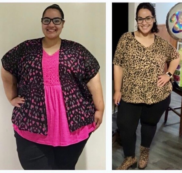 Gabby Before and After